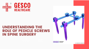 Understanding the Role of Pedicle Screws in Spine Surgery