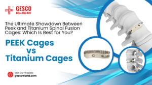 The Ultimate Showdown Between Peek and Titanium Spinal Fusion Cages