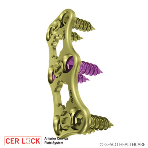 CERLOCK-Anterior Cervical Plate System