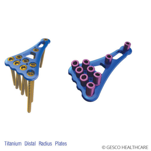 Fracture Plates