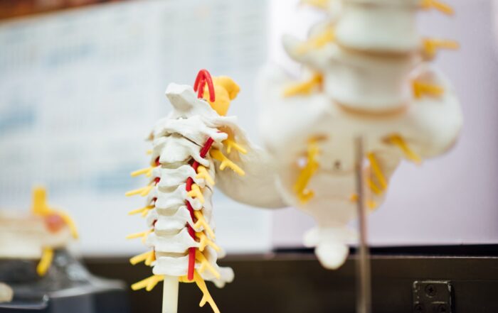 Spinal implants