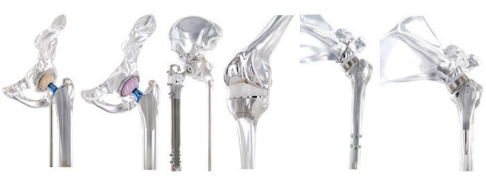 Orthopedic-Implants-2