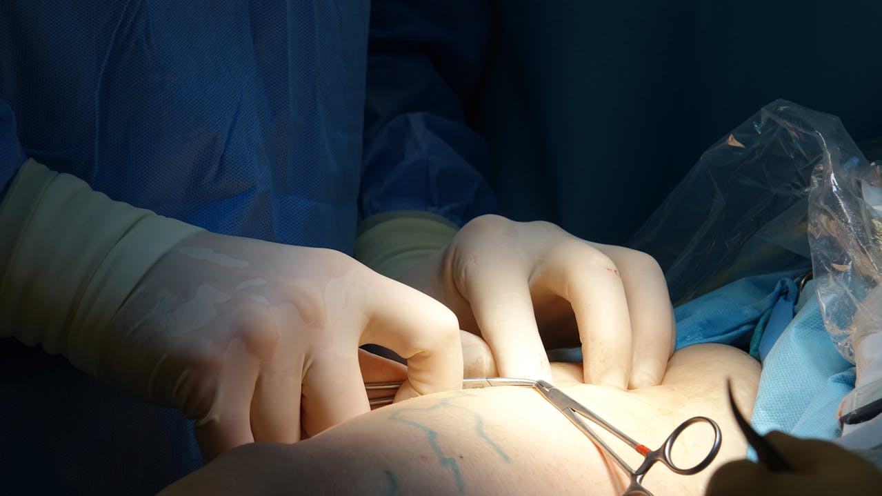 Top Qualities to Look for in a Surgical Implant Supplier